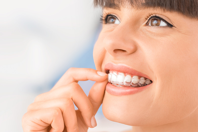 Invisalign® in Davis